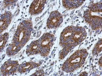 Anti-CCK4 antibody [N1N2], N-term used in IHC (Paraffin sections) (IHC-P). GTX113816