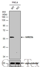 Anti-RAD23B antibody used in Western Blot (WB). GTX113820