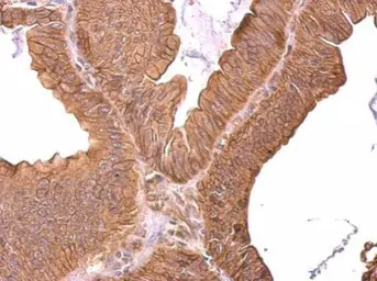 Anti-ROBO1 antibody [C2C3], C-term used in IHC (Paraffin sections) (IHC-P). GTX113826
