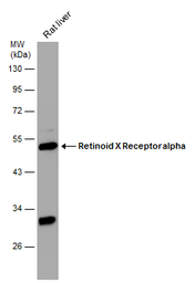 Anti-Retinoid X Receptor alpha antibody used in Western Blot (WB). GTX113828