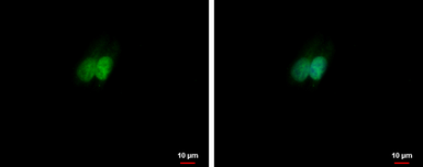 Anti-Retinoid X Receptor alpha antibody used in Immunocytochemistry/ Immunofluorescence (ICC/IF). GTX113829