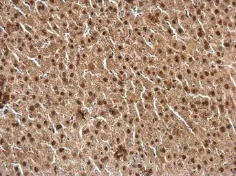Anti-Retinoid X Receptor alpha antibody used in IHC (Paraffin sections) (IHC-P). GTX113829