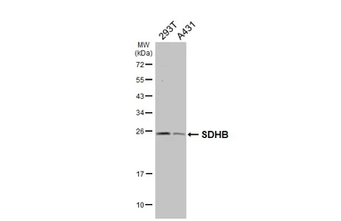 Anti-SDHB antibody used in Western Blot (WB). GTX113833