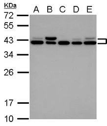 Anti-SET antibody used in Western Blot (WB). GTX113834