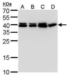 Anti-SET antibody used in Western Blot (WB). GTX113834