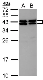 Anti-SET antibody used in Western Blot (WB). GTX113834