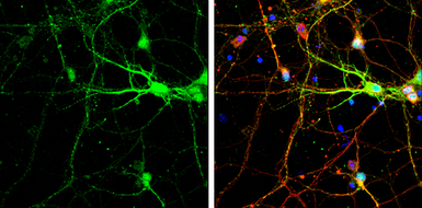 Anti-SNAP25 antibody used in Immunocytochemistry/ Immunofluorescence (ICC/IF). GTX113839
