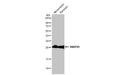 Anti-SNAP25 antibody used in Western Blot (WB). GTX113839