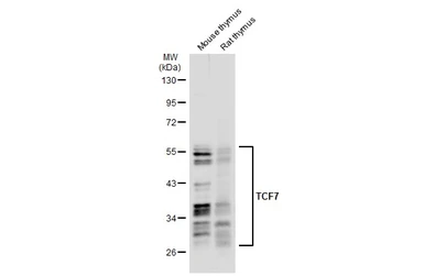 Anti-TCF7 antibody used in Western Blot (WB). GTX113851