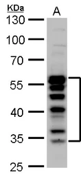 Anti-TCF7 antibody used in Western Blot (WB). GTX113851