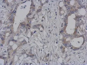 Anti-DAP3 antibody [N1C2] used in IHC (Paraffin sections) (IHC-P). GTX113863