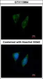 Anti-DAP3 antibody [N1C2-2] used in Immunocytochemistry/ Immunofluorescence (ICC/IF). GTX113864