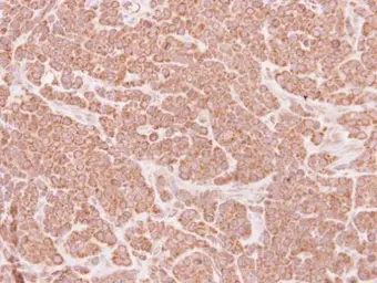 Anti-DAP3 antibody [N1C2-2] used in IHC (Paraffin sections) (IHC-P). GTX113864