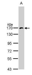 Anti-HPS2 antibody [N1N2], N-term used in Western Blot (WB). GTX113878