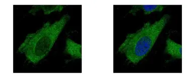 Anti-ARA9 antibody used in Immunocytochemistry/ Immunofluorescence (ICC/IF). GTX113891