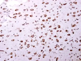 Anti-ARA9 antibody used in IHC (Paraffin sections) (IHC-P). GTX113891