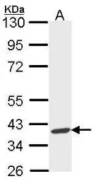 Anti-ARA9 antibody used in Western Blot (WB). GTX113891