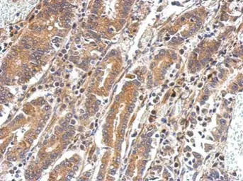 Anti-PAPSS2 antibody [N1N3] used in IHC (Paraffin sections) (IHC-P). GTX113892