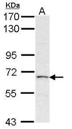 Anti-PAPSS2 antibody [N1N3] used in Western Blot (WB). GTX113892