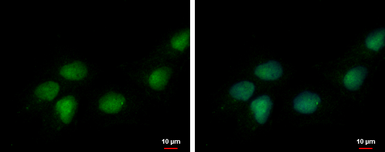 Anti-DEDD antibody used in Immunocytochemistry/ Immunofluorescence (ICC/IF). GTX113895