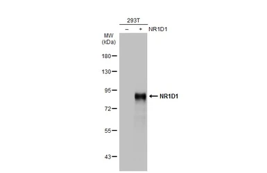 Anti-NR1D1 antibody used in Western Blot (WB). GTX113904