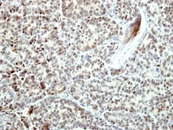 Anti-BCL2L10 antibody [N1C3] used in IHC (Paraffin sections) (IHC-P). GTX113911
