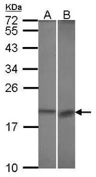 Anti-BCL2L10 antibody [N1C3] used in Western Blot (WB). GTX113911