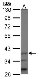 Anti-Jab1 antibody [N1C1] used in Western Blot (WB). GTX113927