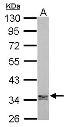 Anti-Jab1 antibody [N1C1] used in Western Blot (WB). GTX113927