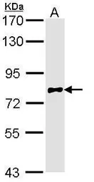 Anti-Calpain 10 antibody [N2C2], Internal used in Western Blot (WB). GTX113930