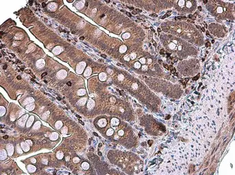 Anti-Coronin 1A antibody [N1N3] used in IHC (Paraffin sections) (IHC-P). GTX113931