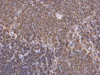Anti-Coronin 1A antibody [N1N3] used in IHC (Paraffin sections) (IHC-P). GTX113931