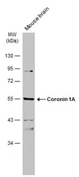 Anti-Coronin 1A antibody [N1N3] used in Western Blot (WB). GTX113931