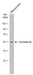 Anti-Coronin 1A antibody [N2C2], Internal used in Western Blot (WB). GTX113932
