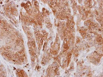 Anti-Coronin 1A antibody [N2C2], Internal used in IHC (Paraffin sections) (IHC-P). GTX113932
