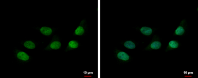 Anti-HP1 alpha antibody used in Immunocytochemistry/ Immunofluorescence (ICC/IF). GTX113944