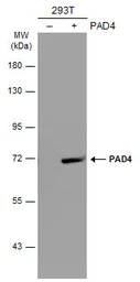 Anti-PAD4 antibody [N1N3] used in Western Blot (WB). GTX113946