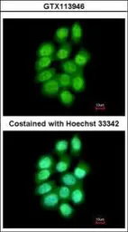 Anti-PAD4 antibody [N1N3] used in Immunocytochemistry/ Immunofluorescence (ICC/IF). GTX113946