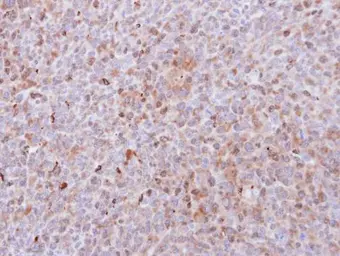 Anti-PAD4 antibody [N1N3] used in IHC (Paraffin sections) (IHC-P). GTX113946