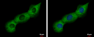 Anti-PABP antibody used in Immunocytochemistry/ Immunofluorescence (ICC/IF). GTX113954