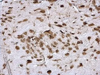 Anti-PABP antibody used in IHC (Paraffin sections) (IHC-P). GTX113954
