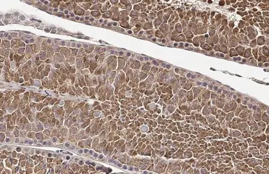 Anti-PABP antibody used in IHC (Paraffin sections) (IHC-P). GTX113954