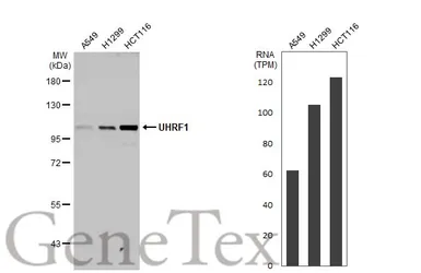 Anti-UHRF1 antibody used in Western Blot (WB). GTX113963