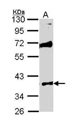 Anti-MST4 antibody [N2C3] used in Western Blot (WB). GTX113976