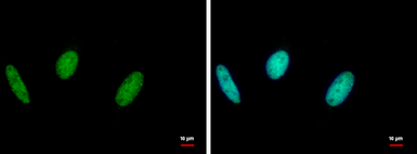 Anti-RAD18 antibody [N1C1] used in Immunocytochemistry/ Immunofluorescence (ICC/IF). GTX113987