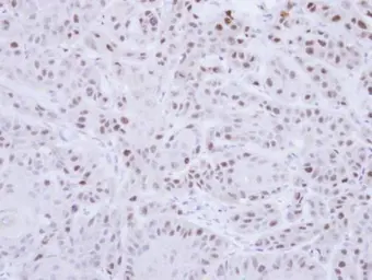 Anti-RAD18 antibody [N1C1] used in IHC (Paraffin sections) (IHC-P). GTX113987