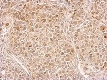 Anti-CIAPIN1 antibody used in IHC (Paraffin sections) (IHC-P). GTX113988