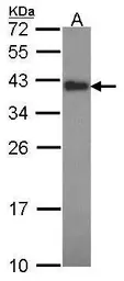Anti-CIAPIN1 antibody used in Western Blot (WB). GTX113988