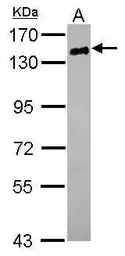 Anti-CD22 antibody [C2C3], C-term used in Western Blot (WB). GTX114015