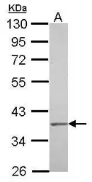 Anti-IGBP1 antibody [N3C3] used in Western Blot (WB). GTX114036